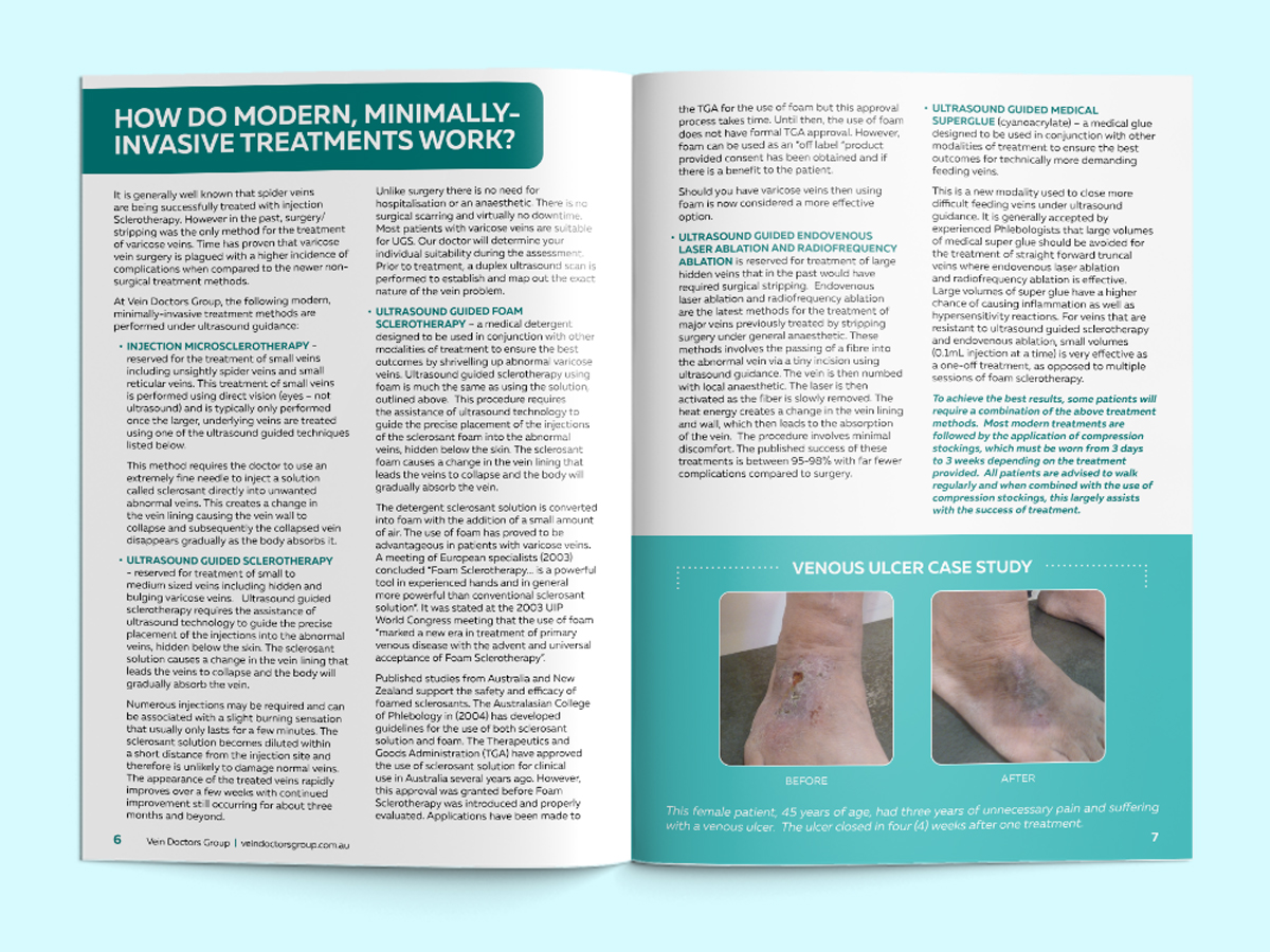 Vein Doctors Group - A4 Brochure - Pages 6 and 7
